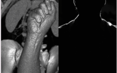 Homem no Pará causa polêmica e viraliza após inserir uma mão de borracha no próprio ânus