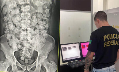 PF prende foragido da justiça do Maranhão com cápsulas de cocaína no estômago ao tentar embarcar para a Espanha