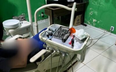 Técnico em prótese dentária é flagrado atuando como dentista em clínica clandestina no interior do MA