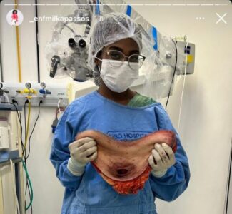 Falta de respeito no mutirão da deputada Cláudia Coutinho em Caxias