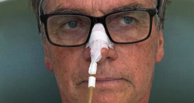 Bolsonaro é diagnosticado com câncer de pele, mas médicos descartam tratamento adicional imediato