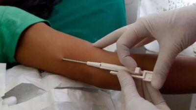 Ministério da Saúde passa a oferecer implante contraceptivo Implanon no SUS