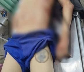 Dois homicídios são registrados em São José de Ribamar; polícia investiga ligação com facção criminosa