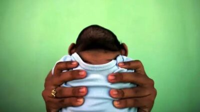 Governo Federal garante direito a indenização de R$ 50 mil e pensão vitalícia de R$ 8.157 para crianças vítimas do Zika