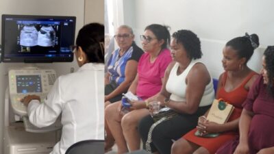 Rosário realiza mutirão de ultrassonografia para atender mil mulheres e reduzir fila de espera