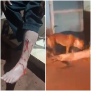 Pit bull ataca morador em Fortaleza dos Nogueiras no MA e reacende debate sobre responsabilidade de donos