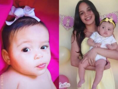 Família pede ajuda para cirurgia de bebê com doença rara em Santana do Maranhão