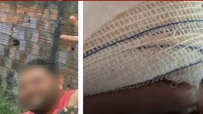 Ciúmes doentio: Marido espanca companheira com pedaço de madeira
