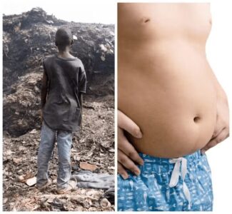 Pela primeira vez, há mais crianças e jovens obesos do que desnutridos no mundo, aponta estudo da Unicef