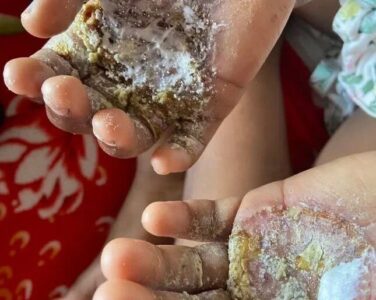 Polícia prende mãe por torturar a filha com ovo em estado de fervura em Niterói