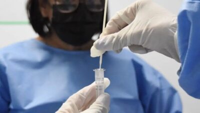 Covid-19 é a principal causa de óbitos por SRAG no Brasil nos meses de agosto e setembro de 2025