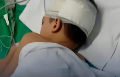 Menino de 7 anos que sofreu descarga elétrica em praça de São Luís permanece hospitalizado