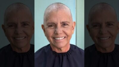 Roseana Sarney tem estado de saúde alterado por efeitos da quimioterapia