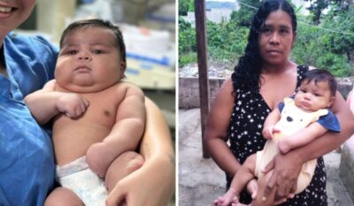 “Bebê gigante” nasce de parto normal pesando quase 7 kg; mãe e criança tiveram complicações no parto