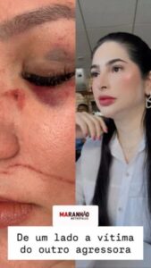 Reviravolta em Confusão: Vereadora Neuriane da Hora Afirma Ter Sido Vítima de Agressão Brutal e Nega Acusações