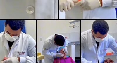 Capinzal do Norte investe em sorrisos: saúde bucal transforma vidas no município