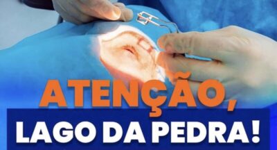 Prefeitura de Lago da Pedra abre cadastros para Mutirão de Cirurgias de Catarata