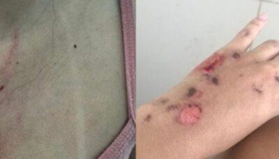 Ao menos 20 mulheres foram vítimas de Cássio Daniel; elas detalham as agressões e golpes financeiros