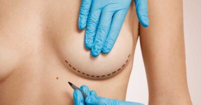Reconstruir o corpo e a alma: o desafio do câncer de mama no Maranhão