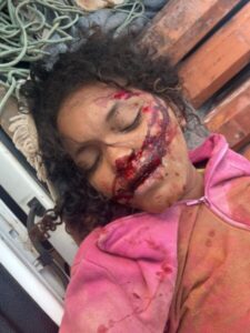 Mulher é encontrada desacordada e machucada após acidente na zona rural em Barreirinhas