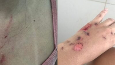 Ex de influenciadora acumula 20 denúncias
