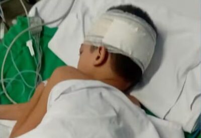 SÃO LUIS: Menino de 7 anos sofre descarga elétrica em poste energizado