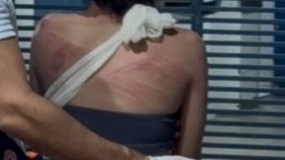 Adolescente é agredida com facão e pauladas em cemitério de Imperatriz