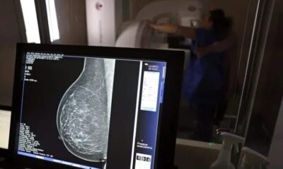 Falta de acesso a mamógrafos limita prevenção do câncer de mama