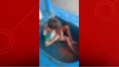 Criança é atacada por porco do mato em Governador Nunes Freire
