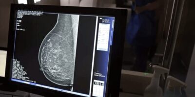 Falta de acesso a mamógrafos limita prevenção do câncer de mama
