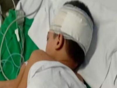 Criança de 7 anos sofre descarga elétrica em poste energizado