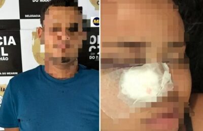 Polícia prende jovem que não aceitou fim de relacionamento e atirou em rosto de adolescente em cidade da Baixada Maranhense