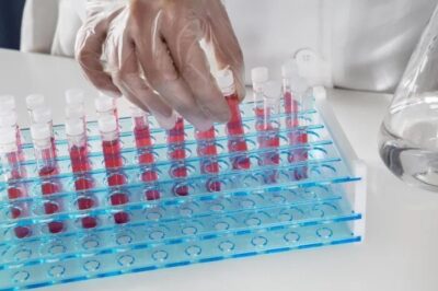 Escovas técnicas mantêm higienização eficiente de vidrarias em laboratórios