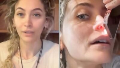 Filha de Michael Jackson mostra perfuração no septo nasal causada pelo consumo de drogas