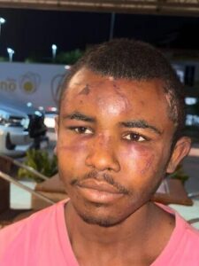 EXECUÇÃO OU EMBOSCADA? MISTÉRIO CERCA MORTE DE ‘MARQUINHOS EM PRESIDENTE VARGAS.