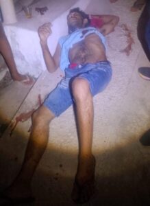 HOMEM É BALEADO NO PEITO EM PLENA VIA PÚBLICA EM CODÓ E LUTA PELA VIDA