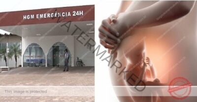 Ministério Público investiga procedimento obstétrico que causou morte de feto antes do parto e distócia de ombros em gestante no HGM