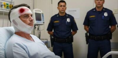 Exames apontam apenas alterações leves após traumatismo craniano em Jair Bolsonaro