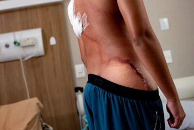 Jovem atingido por raio durante ato de Nikolas Ferreira recebe alta