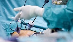 Cirurgia bariátrica: tipos, quando fazer, vantagens e riscos