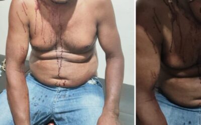 Criminosos encapuzados roubam R$ 2,7 mil e agridem vítima no povoado Boa Esperança, em Cajapió