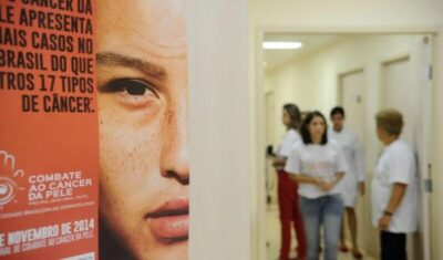 Casos de câncer de pele saltam de 4 mil para mais de 72 mil em 10 anos