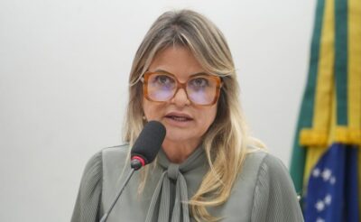 Comissão aprova tratamento contínuo pelo SUS para sequelas graves de queimaduras