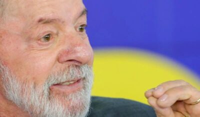 Lula tem evolução satisfatória após cirurgia de catarata