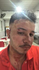 Ex-pré-candidato a prefeito de Turilândia, Gil do Sindicato,  agride cidadão turilandense