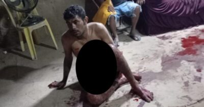 Homem sofre tentativa de homicídio entre Coroatá e Vargem Grande