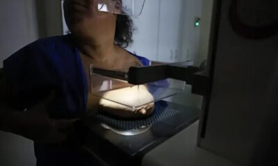 Vigitel: 92% das brasileiras entre 50 e 69 anos fizeram mamografia