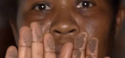 Câncer de pulmão cresce na Vila Embratel e em São Luís