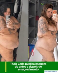 Thais Carla compartilha antes e depois de emagrecimento de 85 quilos