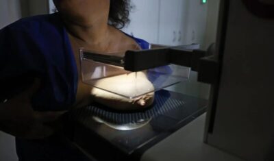 Vigitel: 92% das brasileiras entre 50 e 69 anos fizeram mamografia